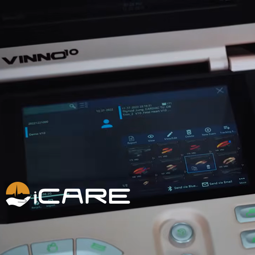 Equipo de ultrasonido