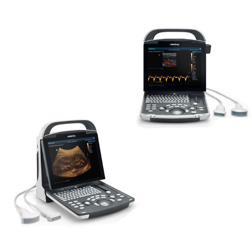 Equipo de ultrasonido portátil