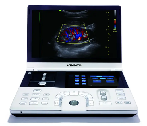 Monitor de signos vitales